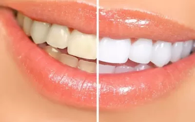 Transform Your Smile: The Magic of Cosmetic Dentistry